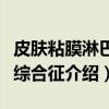 皮肤粘膜淋巴结综合征（关于皮肤粘膜淋巴结综合征介绍）