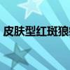 皮肤型红斑狼疮（关于皮肤型红斑狼疮介绍）