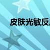 皮肤光敏反应(关于皮肤光敏反应介绍) 皮肤光敏反应(关于皮肤光敏反应介绍)
