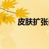 皮肤扩张器（关于皮肤扩张器介绍）