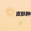皮肤肿瘤（关于皮肤肿瘤介绍）