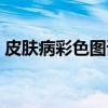 皮肤病彩色图谱（关于皮肤病彩色图谱介绍）