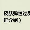 皮肤弹性过度综合征（关于皮肤弹性过度综合征介绍）
