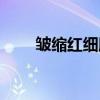 皱缩红细胞（关于皱缩红细胞介绍）