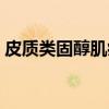皮质类固醇肌病（关于皮质类固醇肌病介绍）