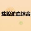 盆腔淤血综合症（关于盆腔淤血综合症介绍）