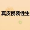 真皮侵袭性生长（关于真皮侵袭性生长介绍）