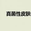 真菌性皮肤病（关于真菌性皮肤病介绍）