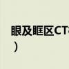 眼及眶区CT检查（关于眼及眶区CT检查介绍）