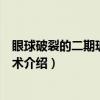 眼球破裂的二期玻璃体手术(关于眼球破裂的二期玻璃体手术介绍) 眼球破裂的二期玻璃体手术(关于眼球破裂的二期玻璃体手术介绍)