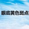 眼底黄色斑点症（关于眼底黄色斑点症介绍）