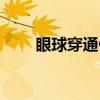 眼球穿通伤（关于眼球穿通伤介绍）