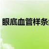 眼底血管样条纹（关于眼底血管样条纹介绍）