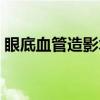 眼底血管造影术（关于眼底血管造影术介绍）