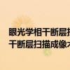 眼光学相干断层扫描成像术原理和临床应用（关于眼光学相干断层扫描成像术原理和临床应用介绍）