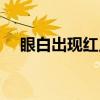 眼白出现红点（关于眼白出现红点介绍）