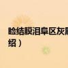 睑结膜泪阜区灰黑色肿物（关于睑结膜泪阜区灰黑色肿物介绍）