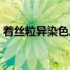 着丝粒异染色质（关于着丝粒异染色质介绍）