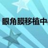 眼角膜移植中心（关于眼角膜移植中心介绍）