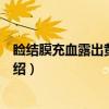 睑结膜充血露出黄色脓块（关于睑结膜充血露出黄色脓块介绍）