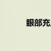 眼部充血（关于眼部充血介绍）