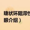 睫状环阻滞性青光眼（关于睫状环阻滞性青光眼介绍）