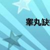 睾丸缺如（关于睾丸缺如介绍）