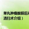 睾丸肿瘤腹膜后淋巴结清扫术（关于睾丸肿瘤腹膜后淋巴结清扫术介绍）