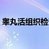 睾丸活组织检查(关于睾丸活组织检查介绍) 睾丸活组织检查(关于睾丸活组织检查介绍)