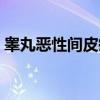 睾丸恶性间皮瘤（关于睾丸恶性间皮瘤介绍）