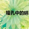 瞳孔中的碎片（关于瞳孔中的碎片介绍）