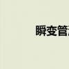 瞬变管流(关于瞬变管流介绍) 瞬变管流(关于瞬变管流介绍)