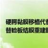 硬腭黏膜移植代替睑板结膜重建眼睑（关于硬腭黏膜移植代替睑板结膜重建眼睑介绍）