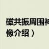 磁共振周围神经成像（关于磁共振周围神经成像介绍）