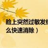 脸上突然过敏发红发痒怎么快速消除（脸上过敏发红发痒怎么快速消除）