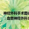 神经外科手术图谱：血管神经外科（关于神经外科手术图谱：血管神经外科介绍）