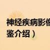 神经疾病影像学图鉴（关于神经疾病影像学图鉴介绍）