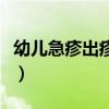 幼儿急疹出疹前征兆（幼儿急疹早期出疹图片）
