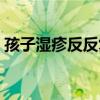 孩子湿疹反反复复怎么根除（孩子湿疹图片）
