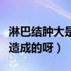 淋巴结肿大是什么原因造成的（孕毒症是怎么造成的呀）