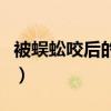 被蜈蚣咬后的伤口图片（被蜈蚣咬伤后的图片）