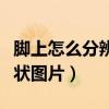 脚上怎么分辨是湿疹还是脚气（艾滋病脚上症状图片）