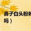 鼻子白头粉刺怎么去除（白头粉刺熟了可以挤吗）