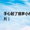 手心起了很多小疙瘩很痒怎么办图片(手心起小疙瘩很痒图片) 手心起了很多小疙瘩很痒怎么办图片(手心起小疙瘩很痒图片)