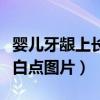 婴儿牙龈上长小白点是怎么回事（婴儿牙龈长白点图片）