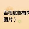舌根底部有肉疙瘩要紧吗（舌根底部有肉疙瘩图片）
