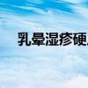 乳晕湿疹硬皮痒非哺乳期（乳晕嫩红素）