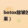 botox除皱效果可以维持多久（botox除皱效果）