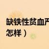 缺铁性贫血严重后果怎样（缺铁性贫血严重会怎样）