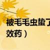 被毛毛虫蛰了吃什么药好（被毛毛虫蛰了最有效药）